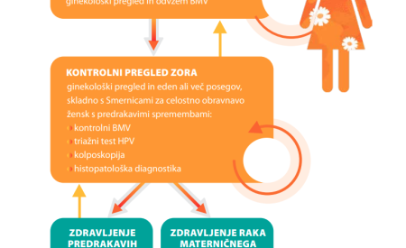 grafični prikaz programa Zora